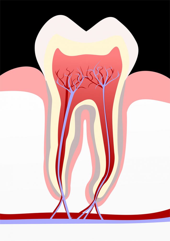 endodoncia