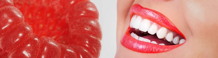 estetica dental