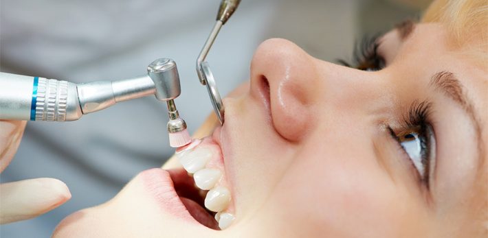limpieza dental en León
