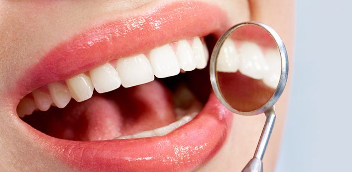 limpieza dental en León