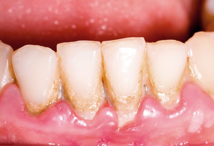 periodoncia