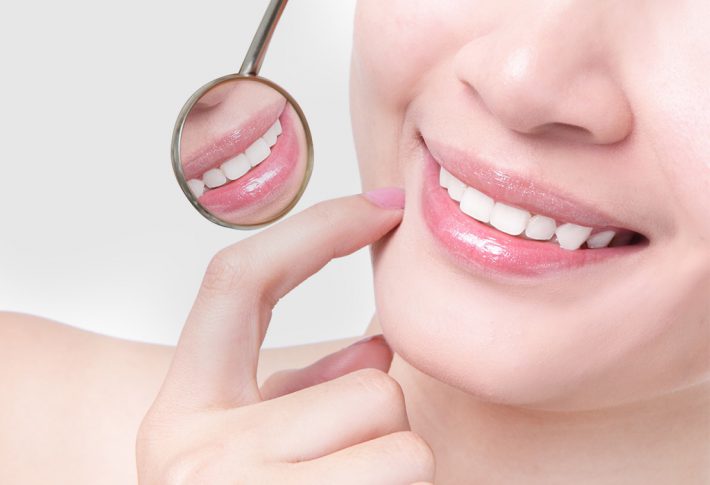 _sonrisa2